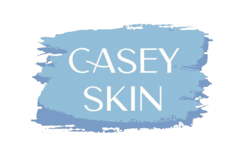 Casey Skin